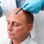 Turkey's Best Hair Transplant Clinics in 2026