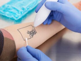 What to Know Before Committing to a New Tattoo