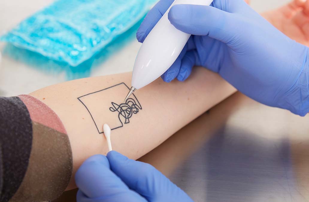 What to Know Before Committing to a New Tattoo