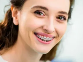 Adult Braces — Straighten Your Smile No Matter the Age.