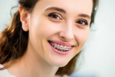 Adult Braces — Straighten Your Smile No Matter the Age.