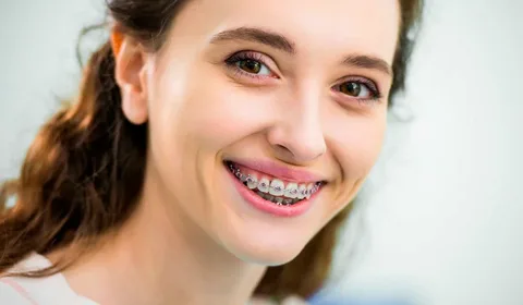 Adult Braces — Straighten Your Smile No Matter the Age.