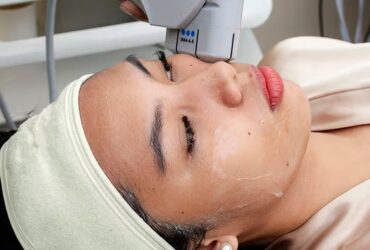 Understanding HIFU Treatment for Non-Surgical Facelifts