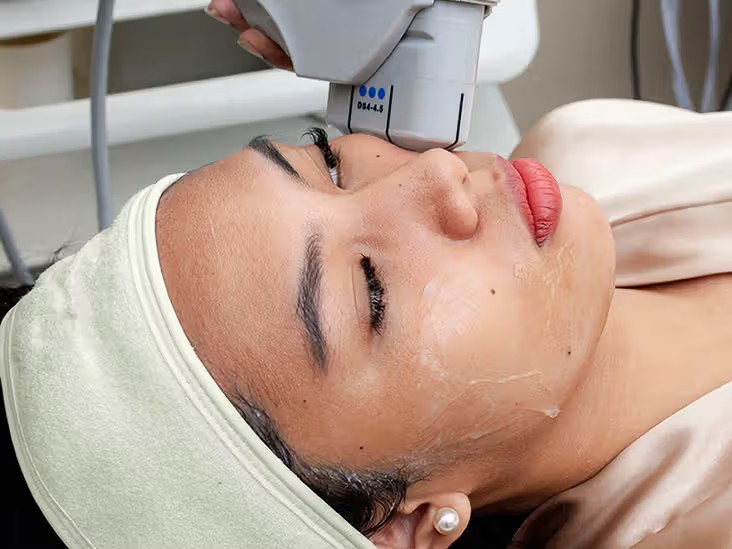 Understanding HIFU Treatment for Non-Surgical Facelifts